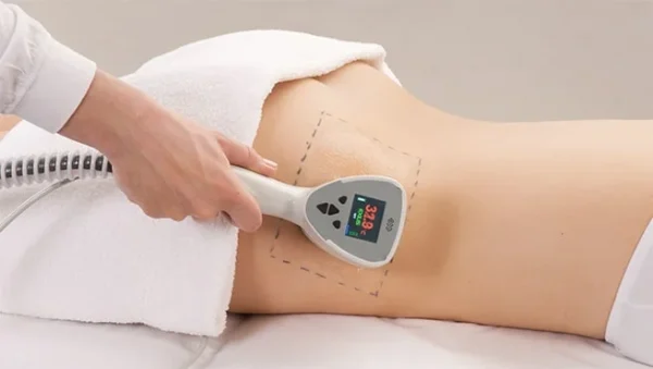Fat Burner Exilis °360