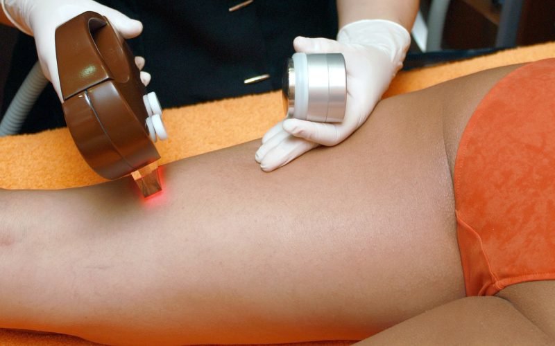 hair-removal-4188610_1280